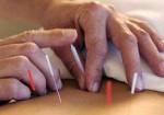 acupuntura-natal-1414502218