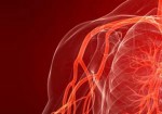 angiologia-natal-1414502854