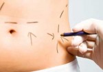 cirurgia-plastica-natal-1414435773
