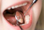 odontopediatria-natal-1414513197