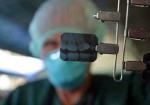 radiologia-odontologica-natal-1414515363