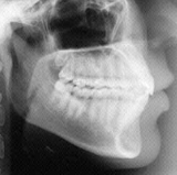Radiologia Odontológica em Natal